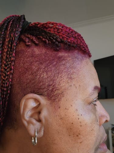 Customer showing results of the Instant Dye Shampoo on their shaven, reddish-pink hair.