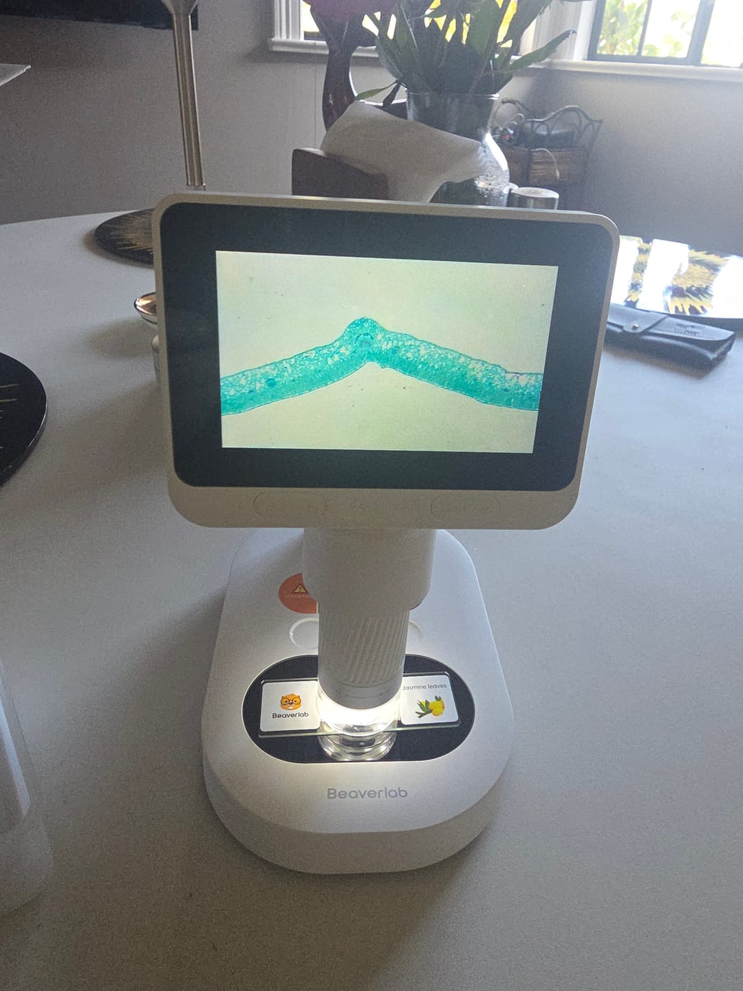 Customer photo review of Darwin M2 – Professional-Grade Digital Microscope with 1600X Zoom