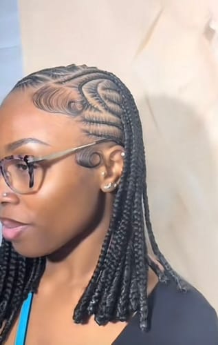 Customer photo review of Minoxidil High Strength (5%) SOLUTION, 3x60ml pack