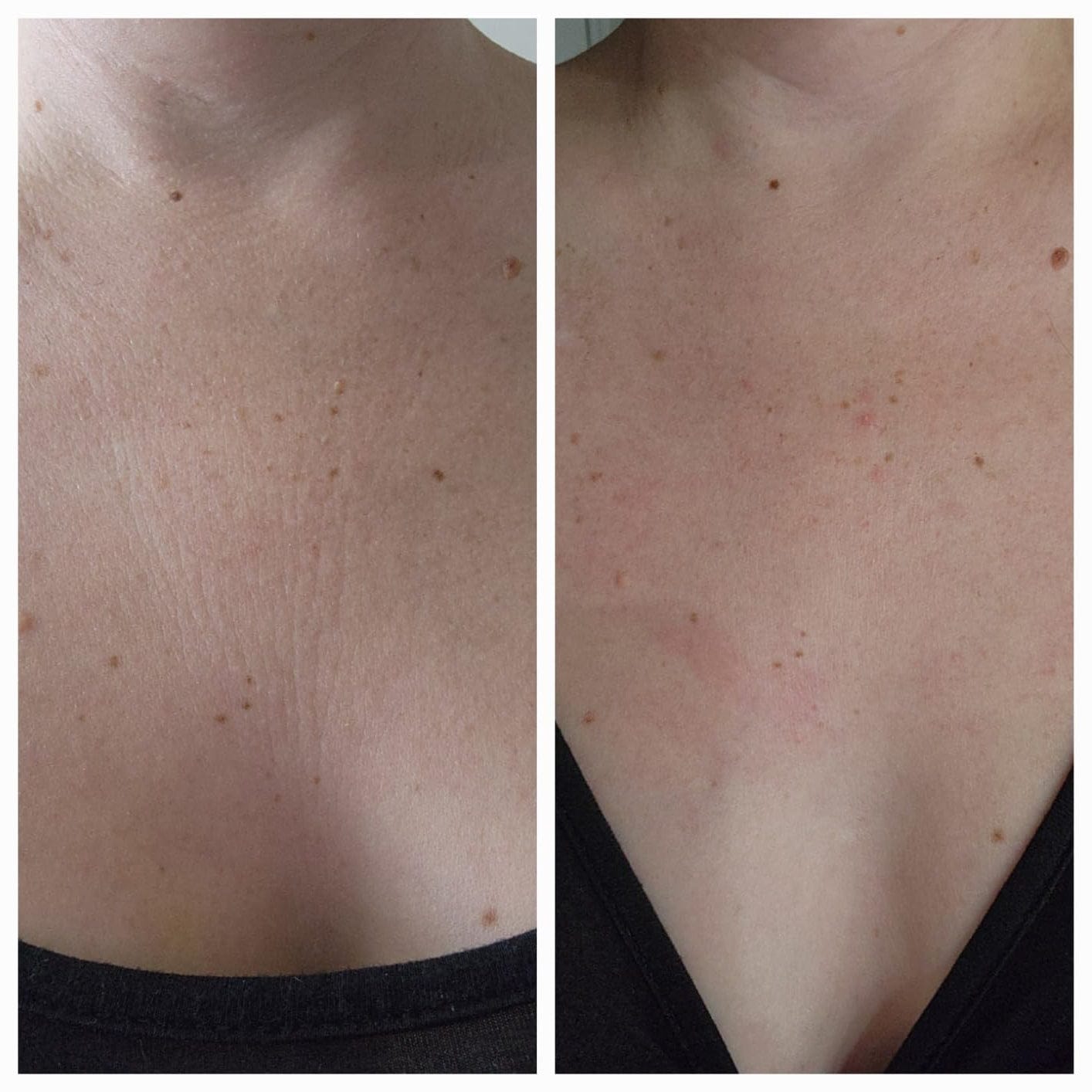 Customer photo review of Пластири за бюст