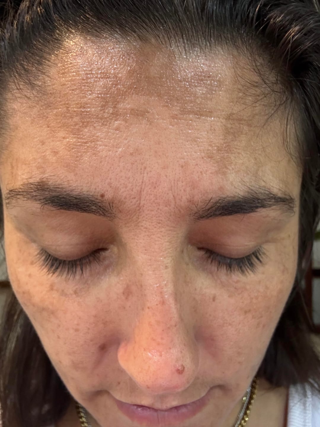 Customer photo review of LashGrow Serum