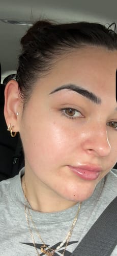 Reviewer's face with a bright and hydrated complexion after using the Vitamin C 10% HYPERBOOST® Serum.