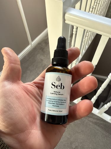 Customer photo review of Seb Natural Calming Serum