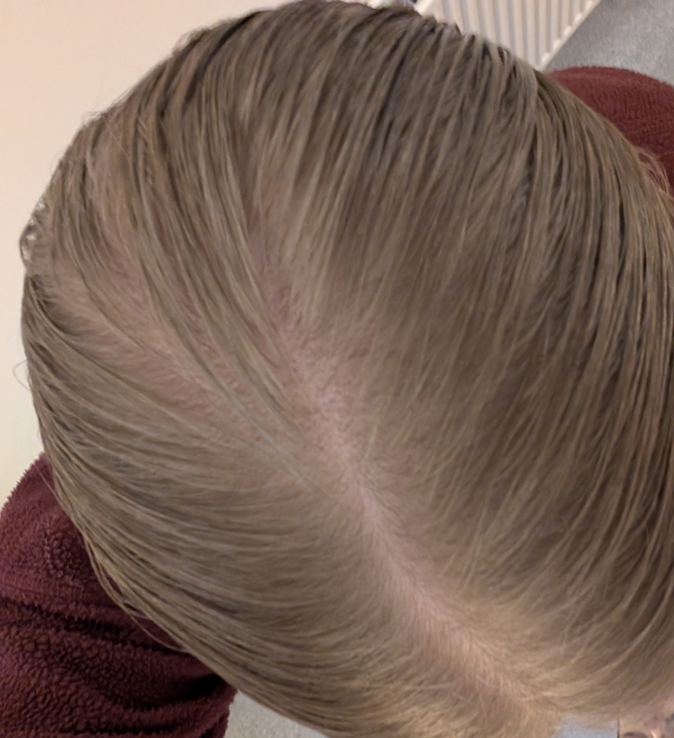 Real Growplex customer scalp