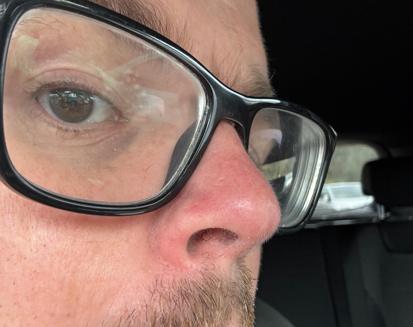 Customer photo review of Rosalique 3 in 1 Anti-Redness Miracle Formula SPF50