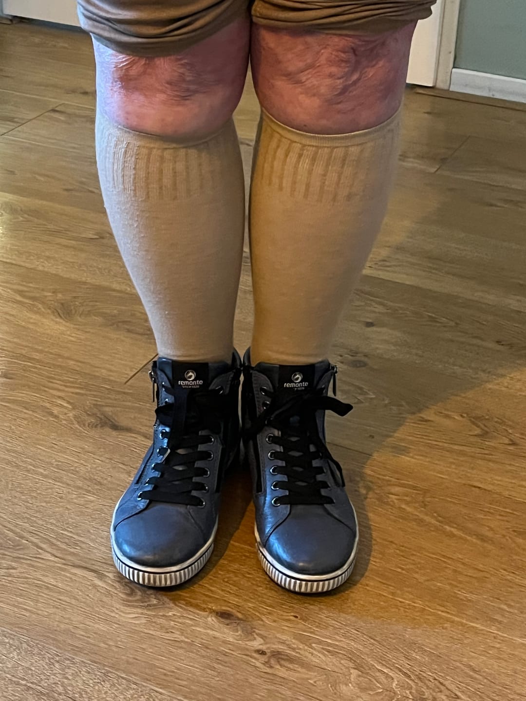 Customer photo review of Essential Compression Socks Warm Taupe