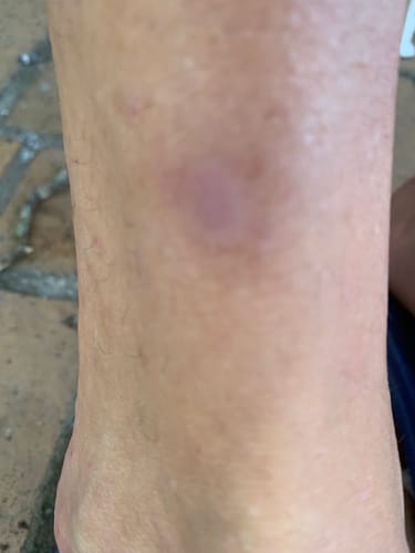 Customer photo review of Healing Balm