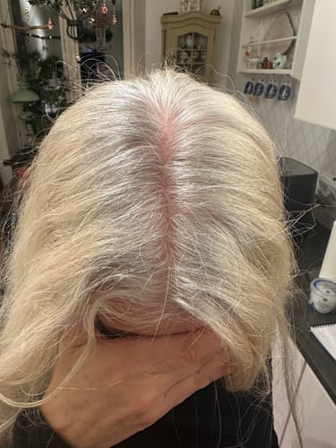 Customer photo review of Sunkissed Starter Kit