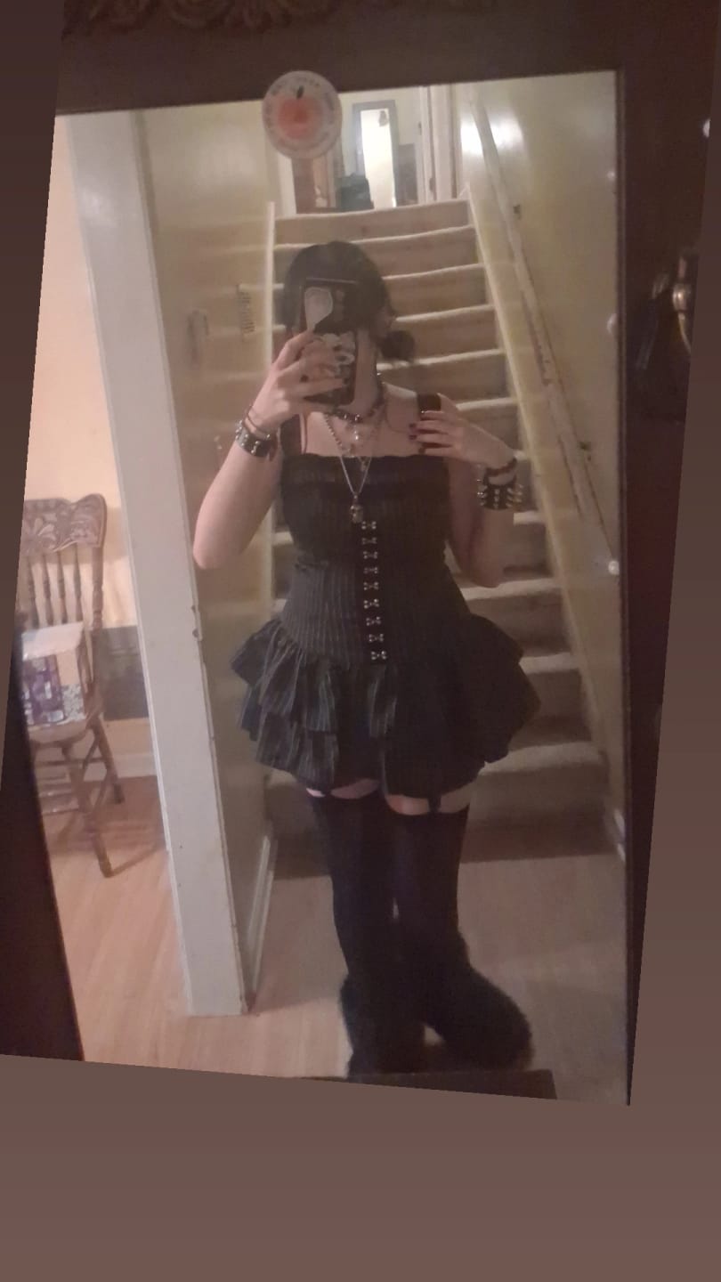 Customer photo review of Grunge Doll Stripes Flared Romper Dress 3.0 (split two-piece set)