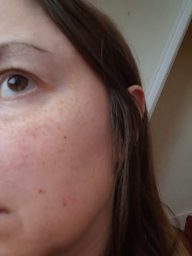 Customer photo review of Seb Natural Soothing Balm