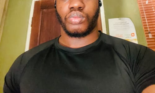 Customer photo review of Minoxidil High Strength (5%) FOAM, 3x60ml pack