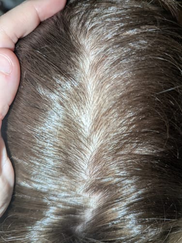 Customer photo review of Seb Natural Calming Serum