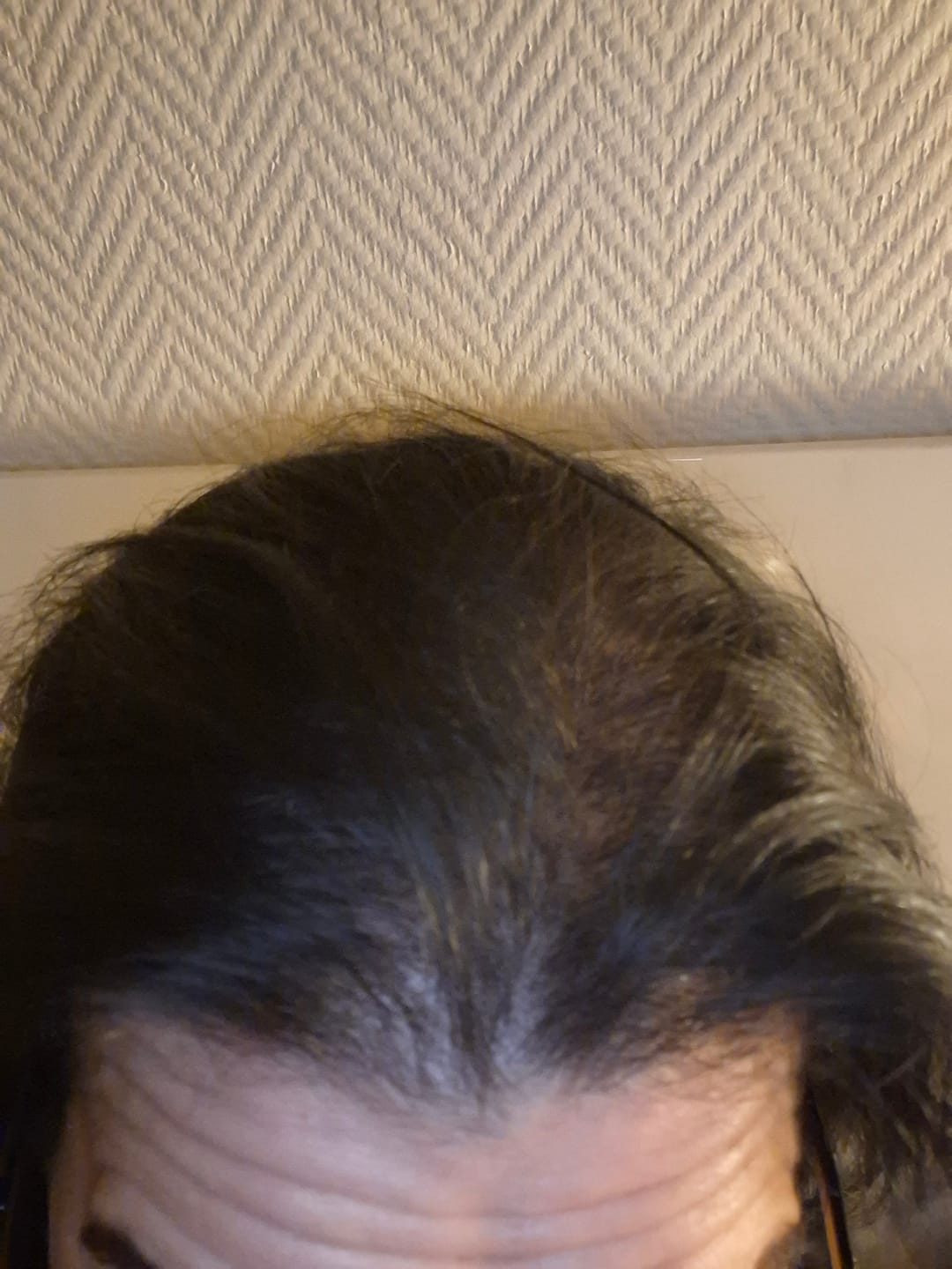 Customer photo review of Camouflage capillaire