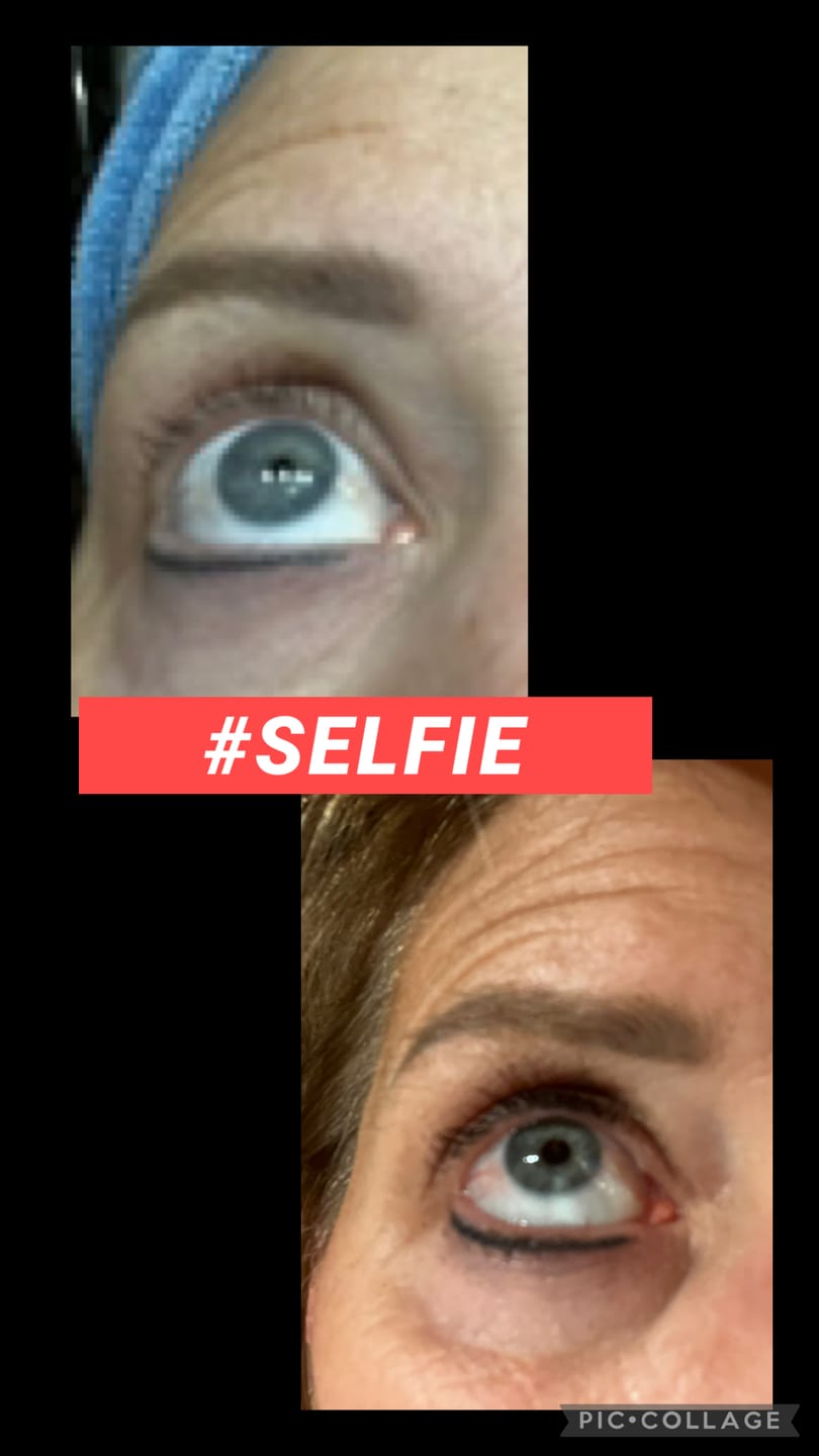Customer photo review of EYELASH GROWTH SOLUTION