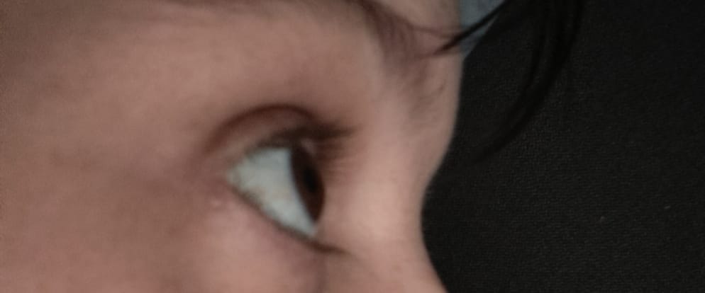 Customer photo review of LASH SERUM