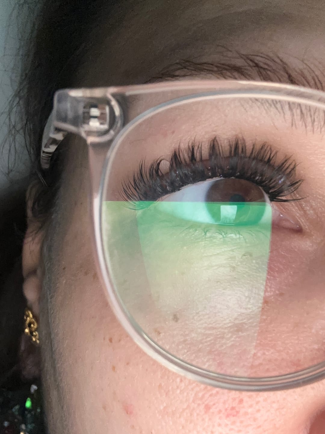 Customer photo review of THE CANCER (Krebs 5-11 mm)