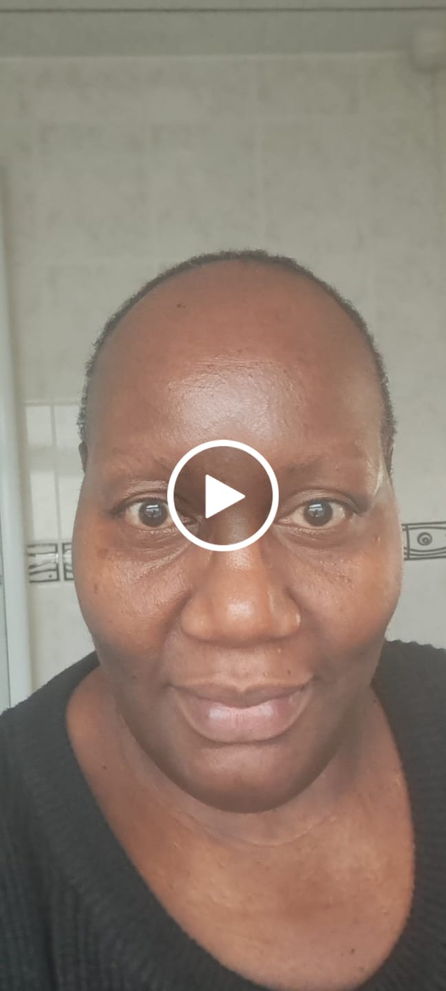 Customer video review of 5-Step Clear Skin Kit