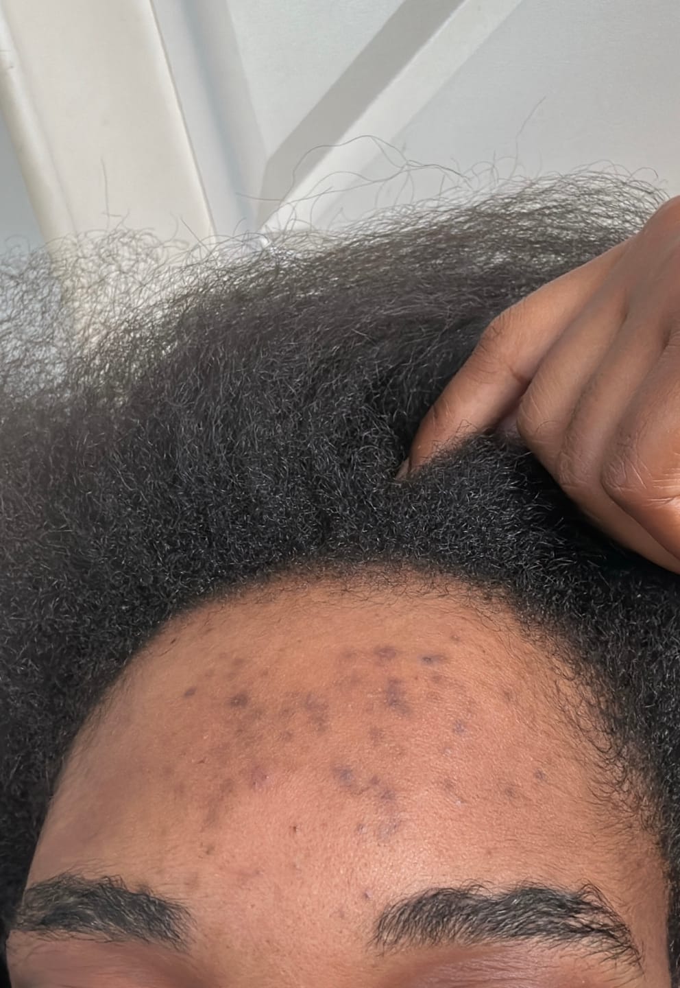 Customer photo review of Duo Skincare Bundle