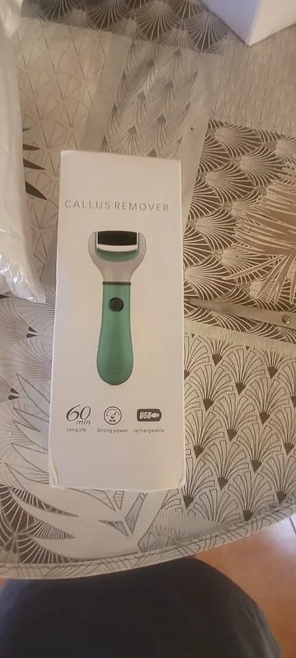 Customer photo review of Electric Foot File Callus Remover for Smooth Feet