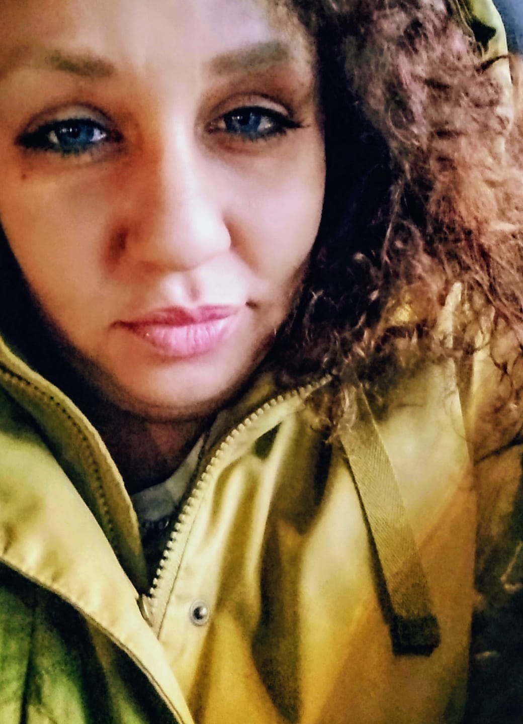 Customer photo review of New York Blue Prescription Colored Contact Lenses