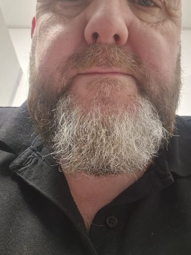 Customer photo review of Seb Natural Calming Serum