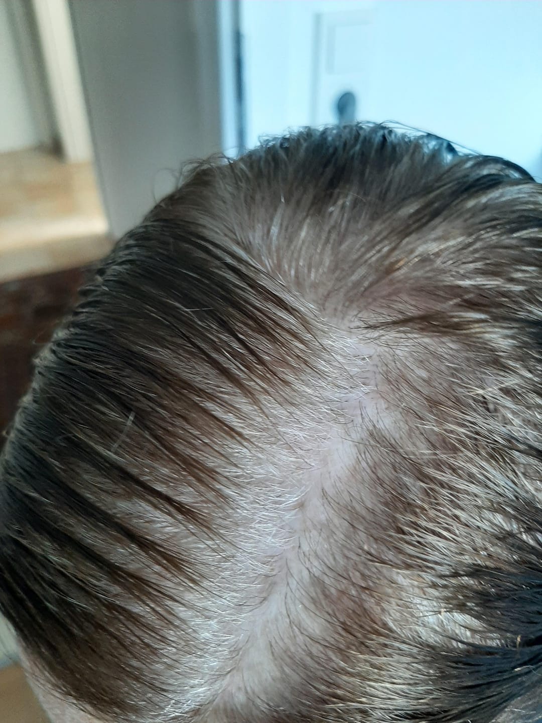 Customer photo review of Fibre Per Capelli COTTONFIX 28 gr.