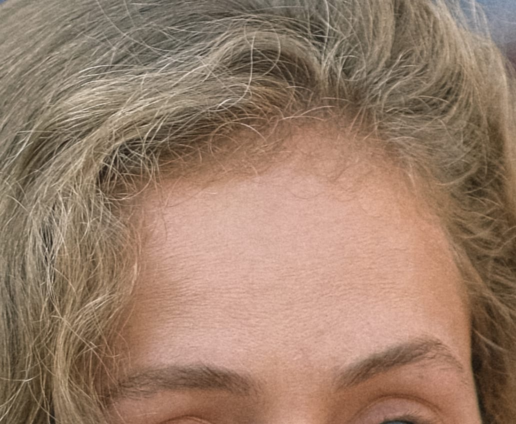 Customer photo review of Fibre Per Capelli COTTONFIX 28 gr.