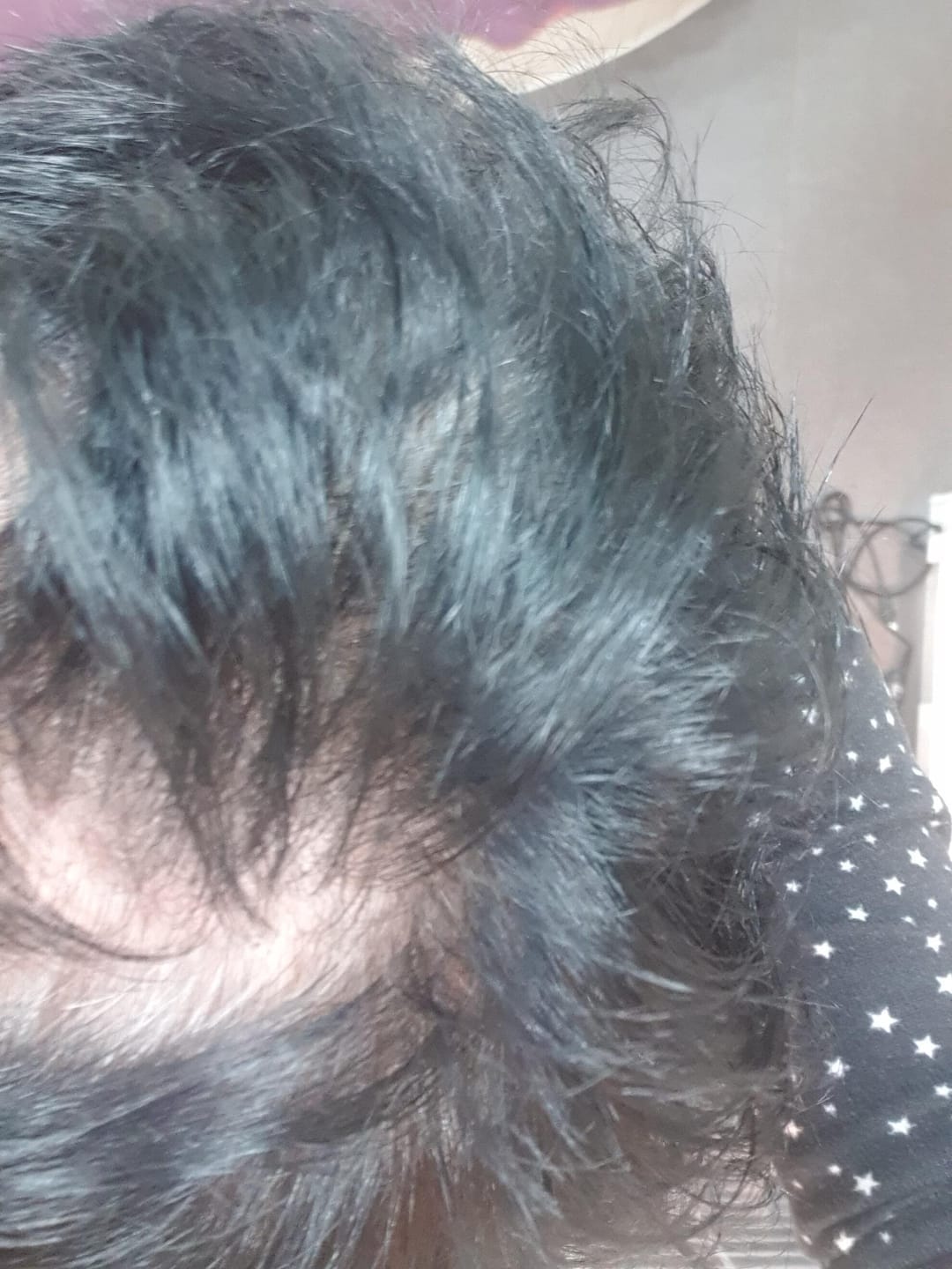 Customer photo review of Fibre Per Capelli COTTONFIX 28 gr.