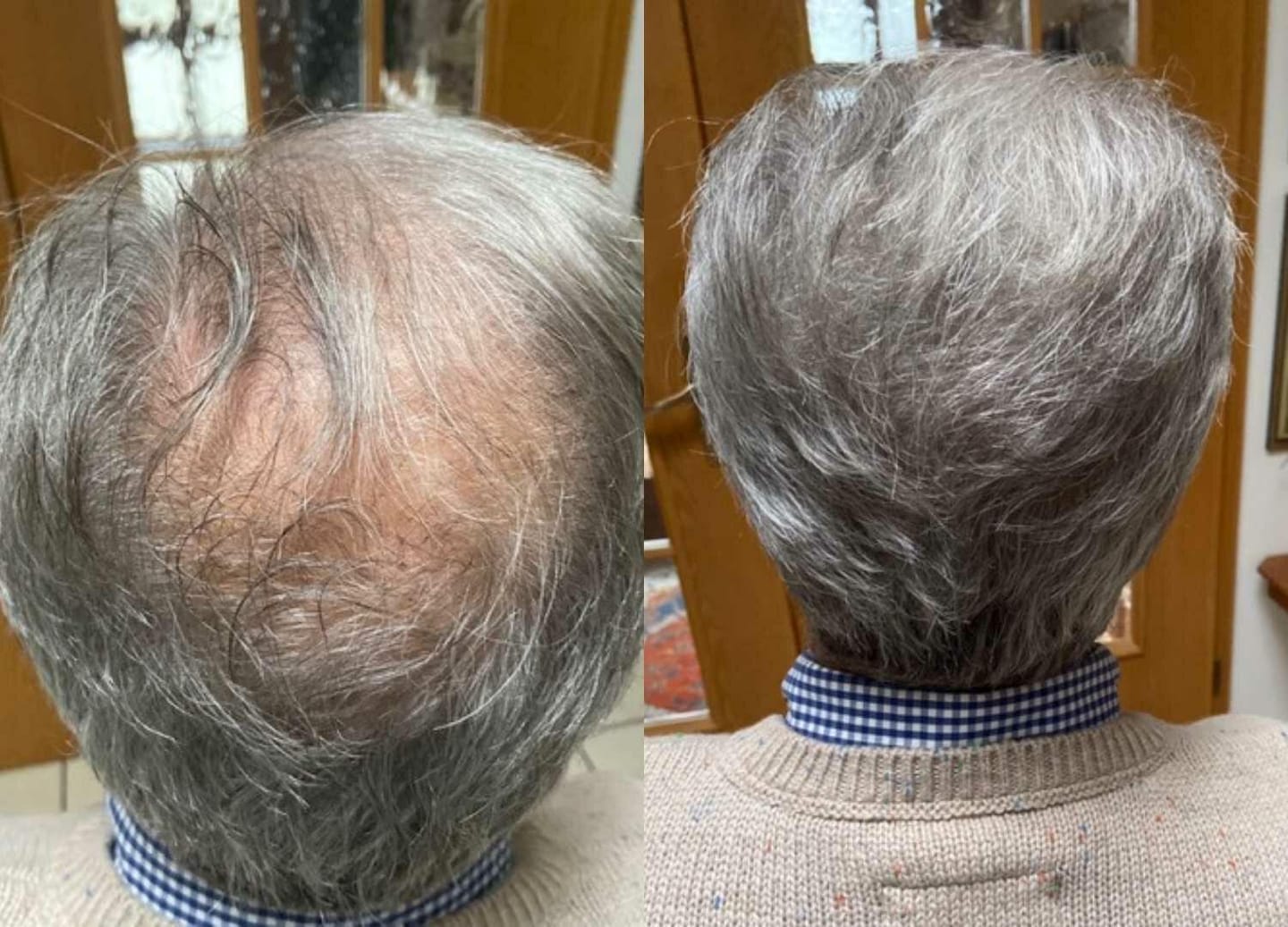 Customer photo review of Fibre Per Capelli COTTONFIX 28 gr.