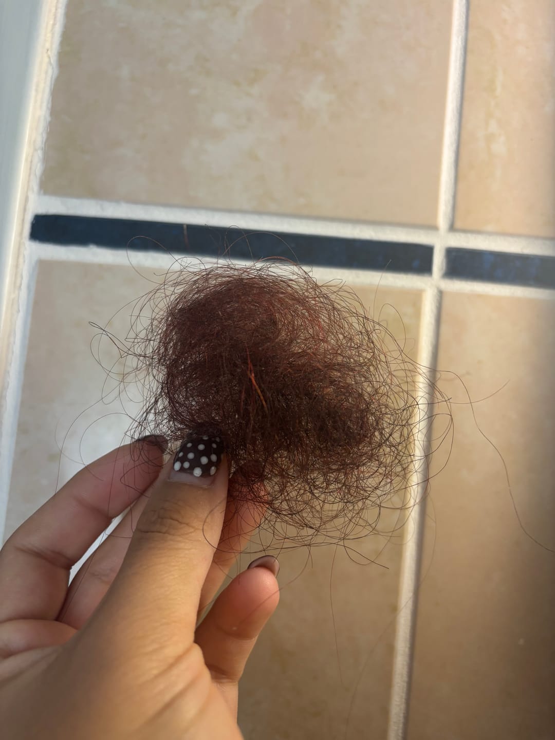 Customer photo review of Synergie Hair Loss