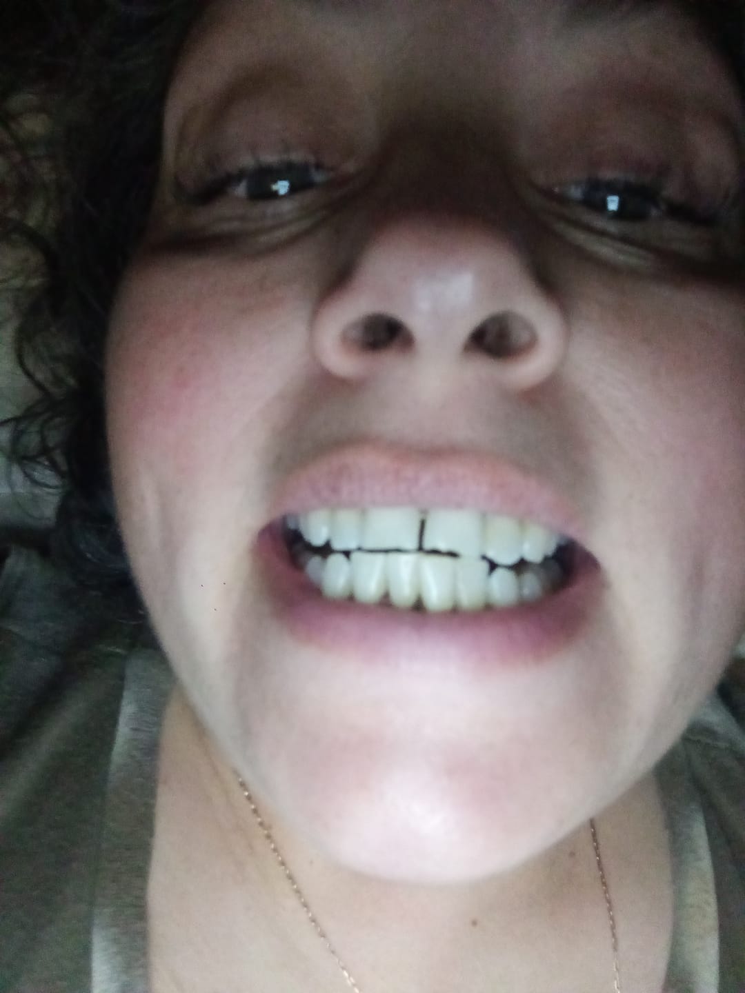 Customer photo review of Kit Smile+