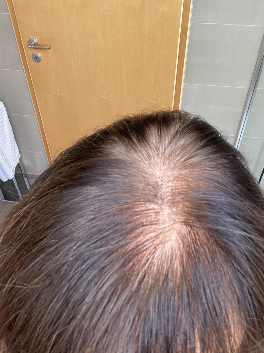 Customer photo review of Fibre Per Capelli COTTONFIX 28 gr.