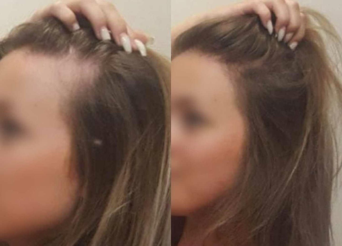 Customer photo review of Fibre Per Capelli COTTONFIX 28 gr.