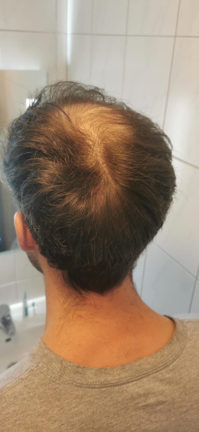 Customer photo review of Fibre Per Capelli COTTONFIX 28 gr.