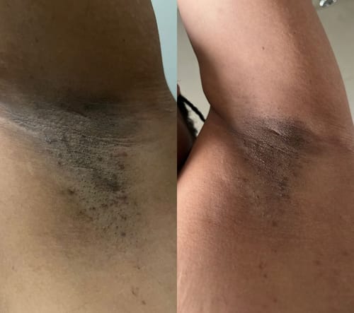 Customer photo review of Body Brightening Bundle