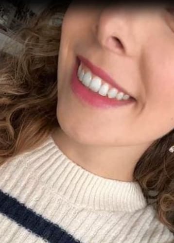 Customer photo review of Branqueador dental V34