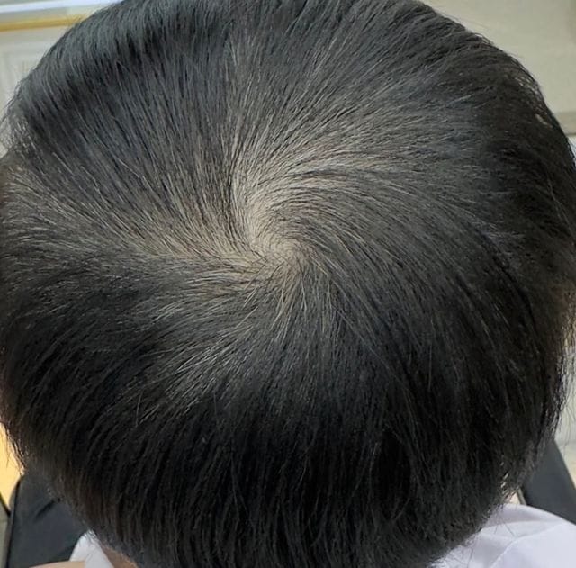 Customer photo review of [ SMIB ] -LactoBio Shampoo >Anti Frizz & Repair Series