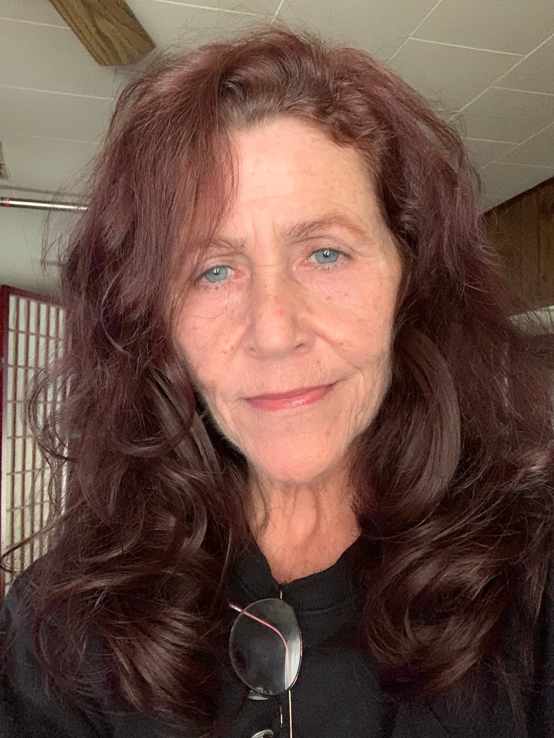 Customer photo review of Glov Anti-Aging Serum (5ml)