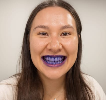 Customer photo review of Branqueador dental V34