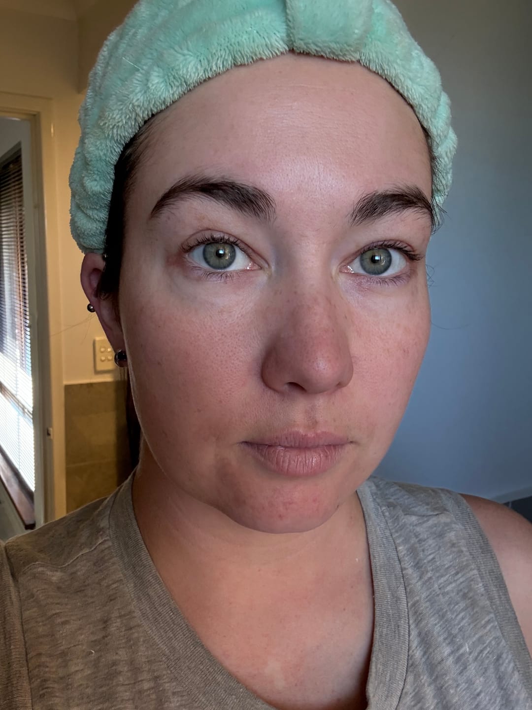 Customer photo review of BRIGHT & TIGHT UNDER EYE CREAM