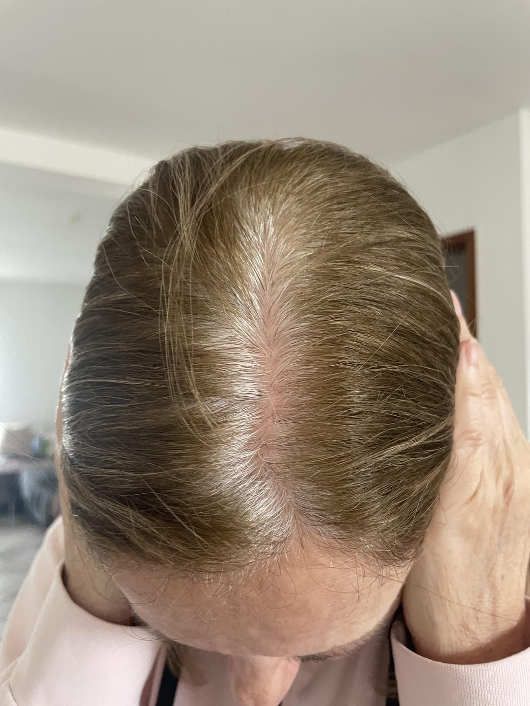 Customer photo review of Fibre Per Capelli COTTONFIX 28 gr.