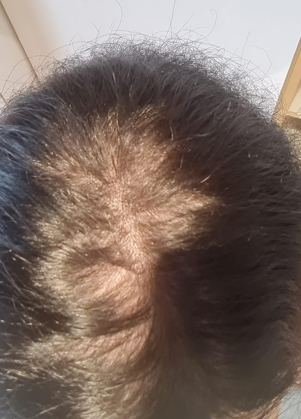 Customer photo review of Fibre Per Capelli COTTONFIX 28 gr.