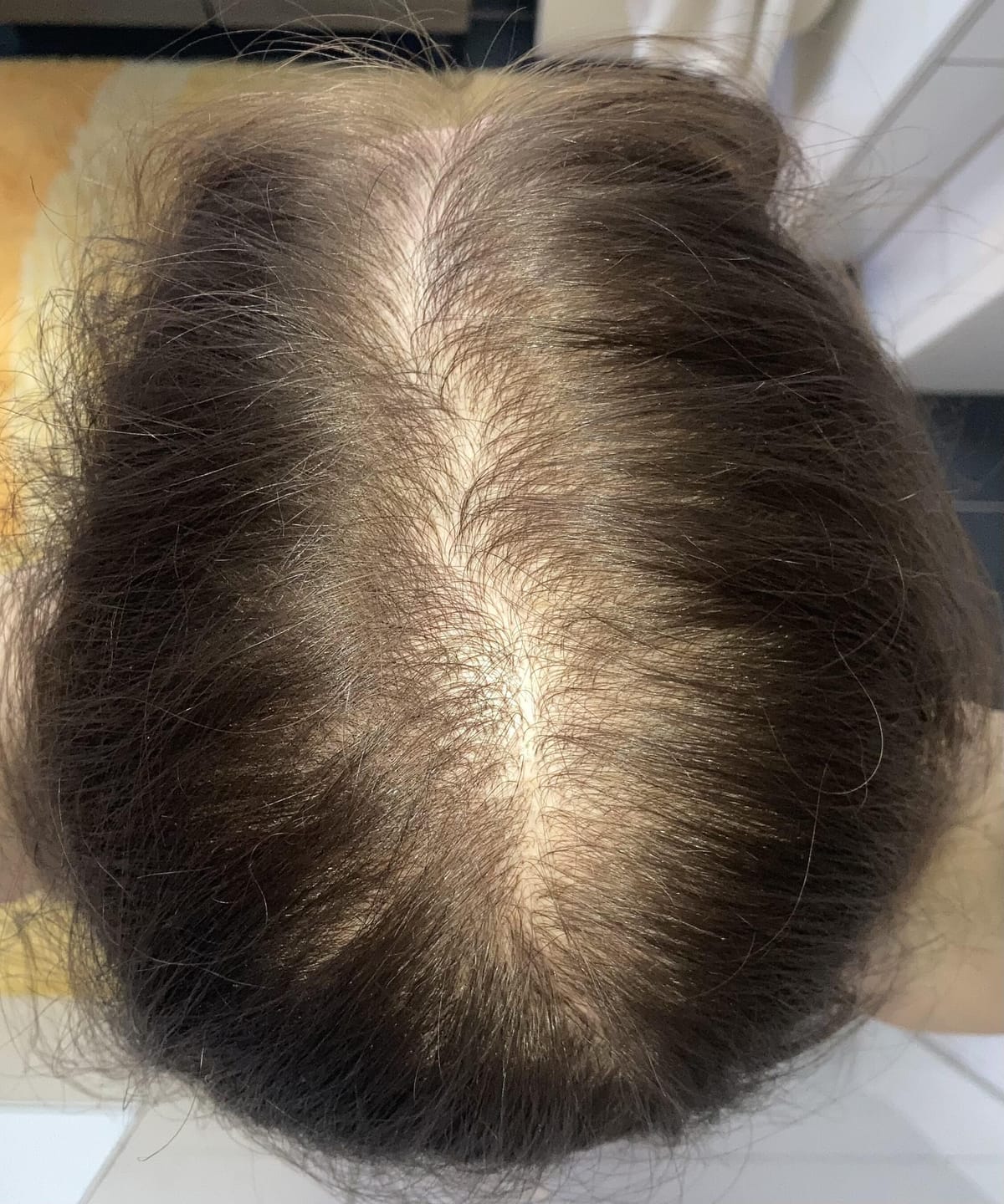 Customer photo review of Fibre Per Capelli COTTONFIX 28 gr.