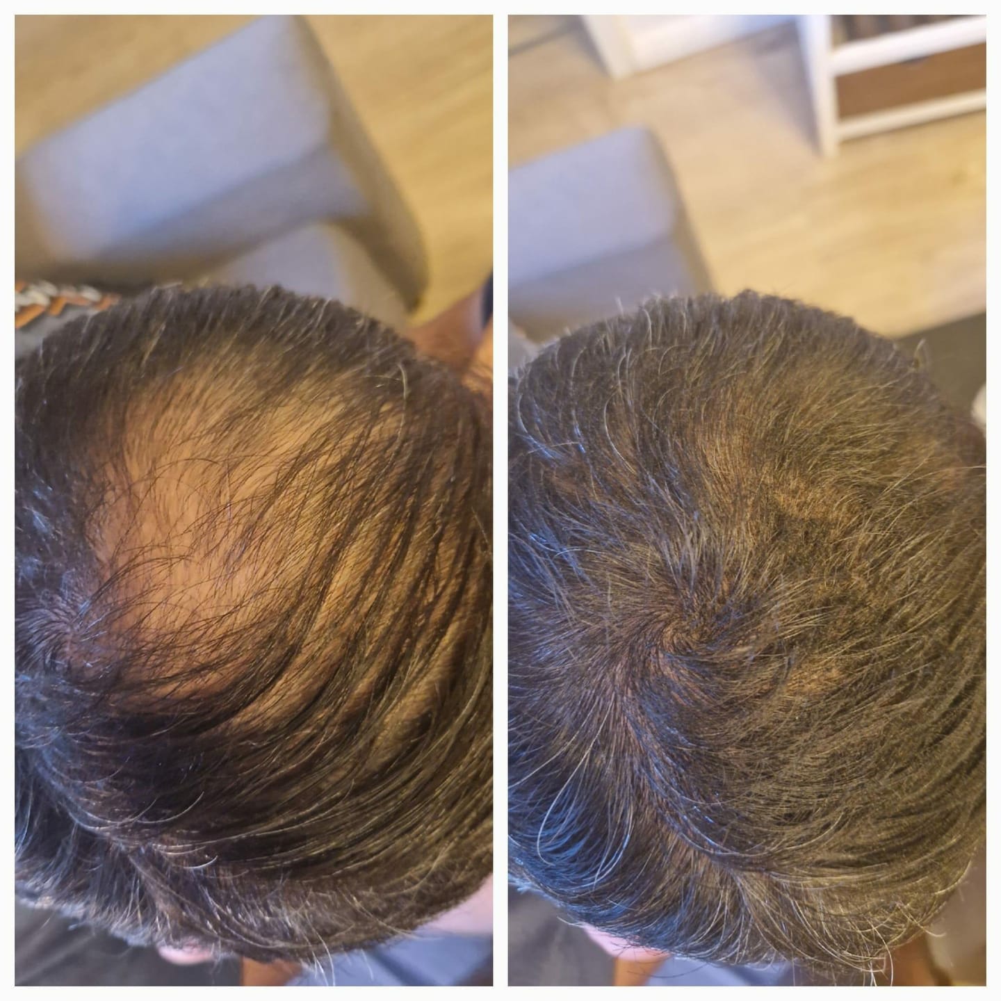 Customer photo review of Fibre Per Capelli COTTONFIX 28 gr.