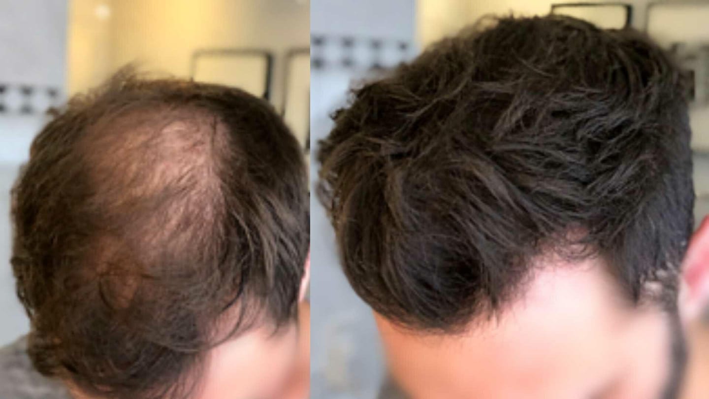 Customer photo review of Fibre Per Capelli COTTONFIX 28 gr.
