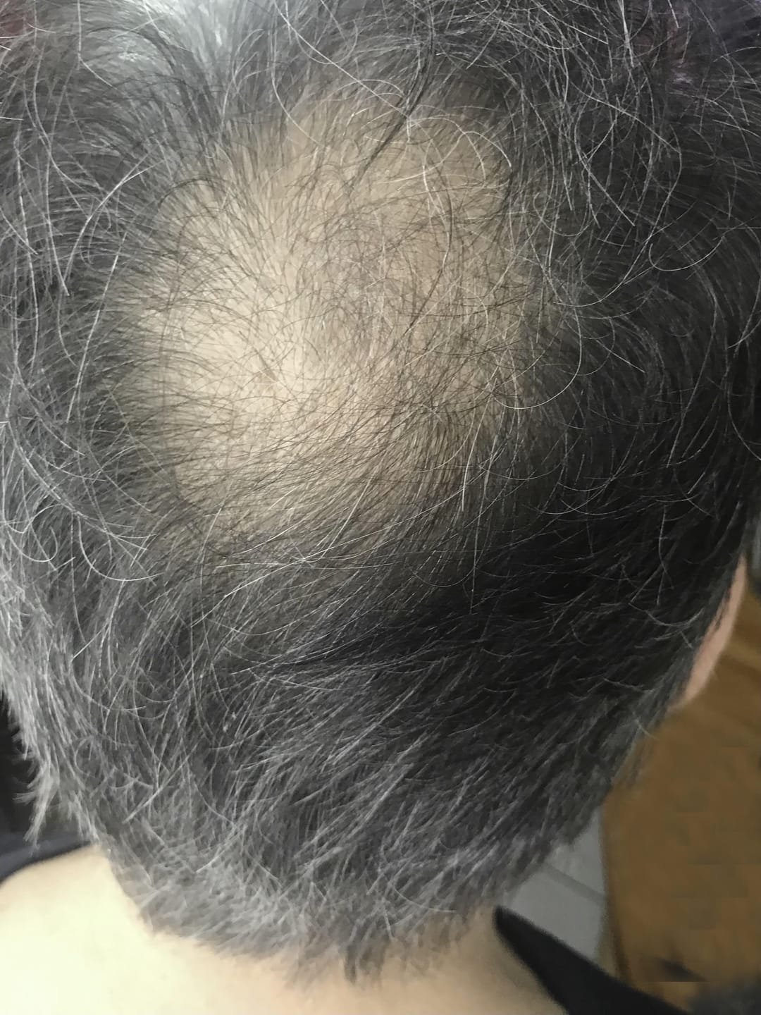 Customer photo review of Fibre Per Capelli COTTONFIX 28 gr.