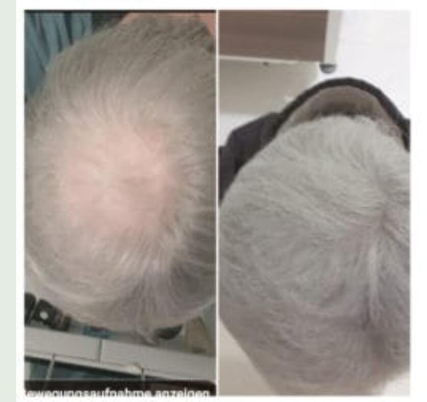 Customer photo review of Fibre Per Capelli COTTONFIX 28 gr.