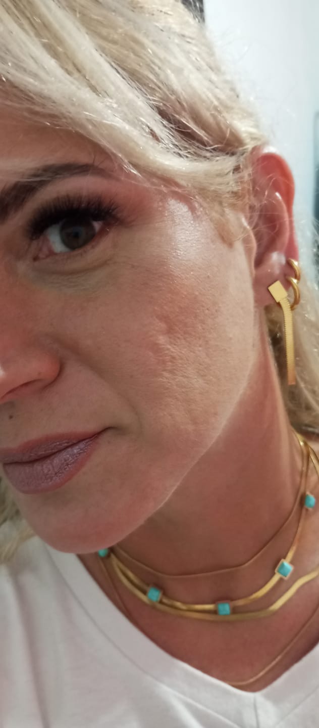 Customer photo review of Brinco Catarina Malha Metal Banhado em Ouro 18K