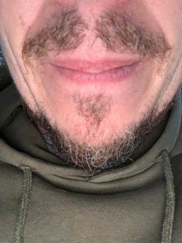 Customer photo review of Seb Natural Calming Serum