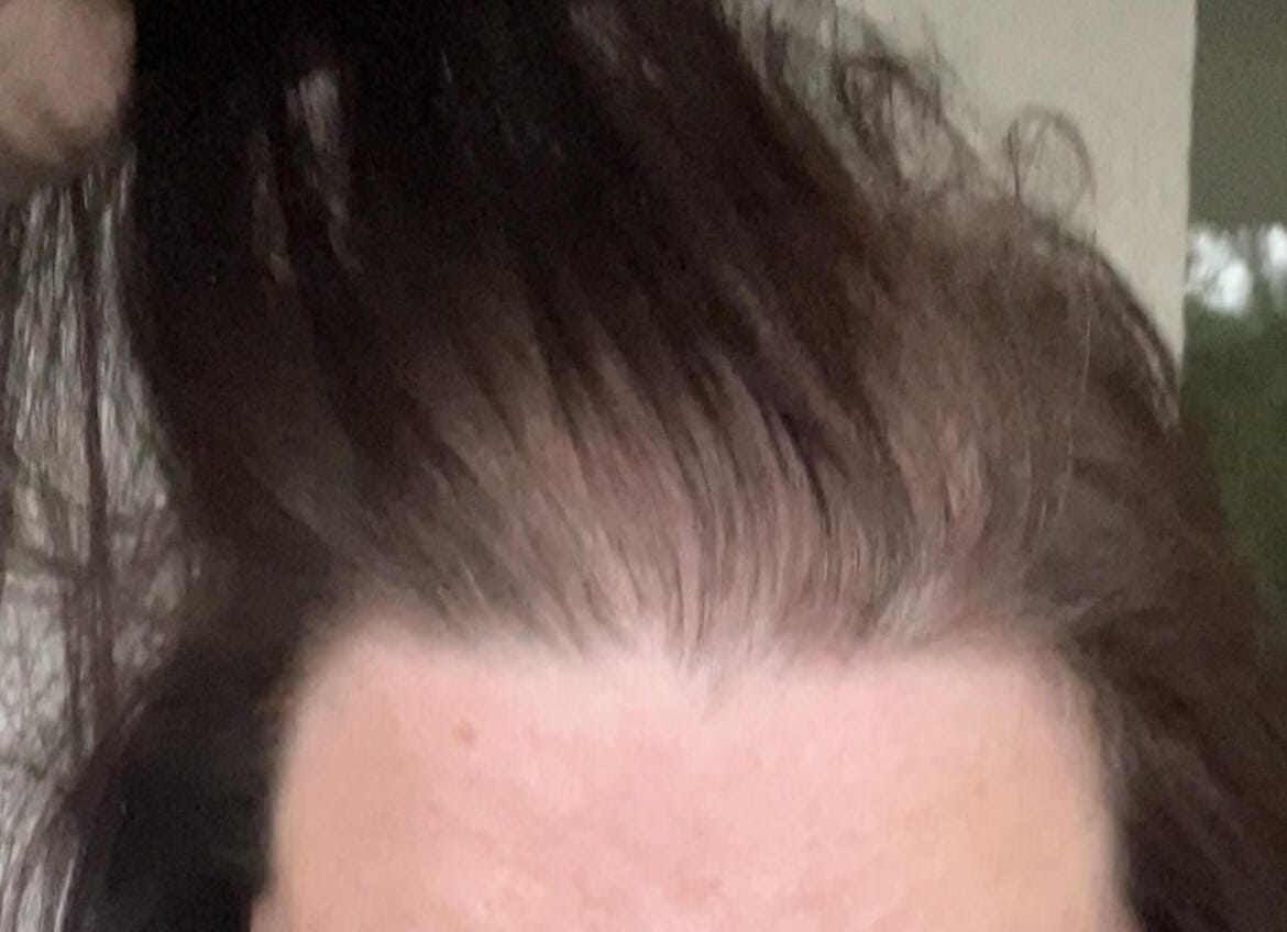 Customer photo review of Fibre Per Capelli COTTONFIX 28 gr.